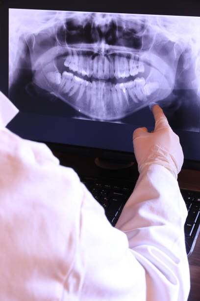 Best Chipped Tooth Repair Near Me  in North Wantagh, NY